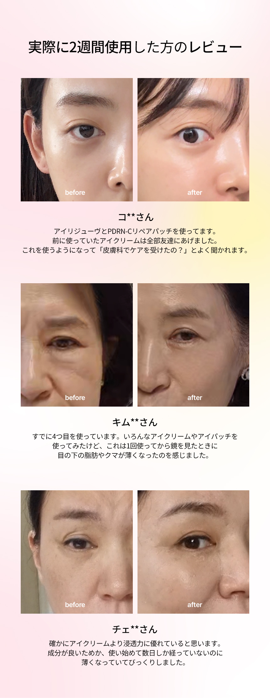 Qoo10] BEAUND アイリジューブ＋PDRNアイパッチセット