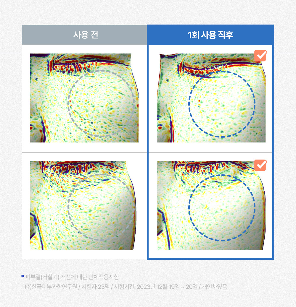 16. 워터핏패드30매_사용임상.jpg