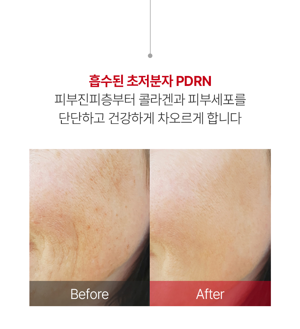 닥터스pdrn-상세페이지_07.jpg